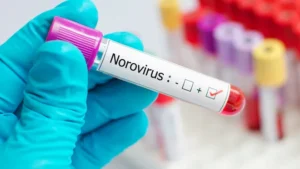 Norovirus Outbreak in the US: Symptoms and Prevention Tips from Experts
